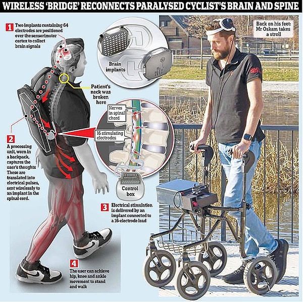 Лучшее в этом то, что система работает без проводов, что позволяет пациенту передвигаться самостоятельно.