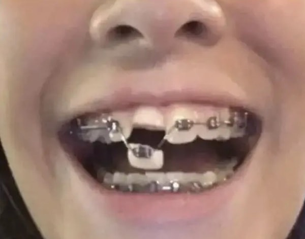 14. Ужасная (и очень дорогая) авария: