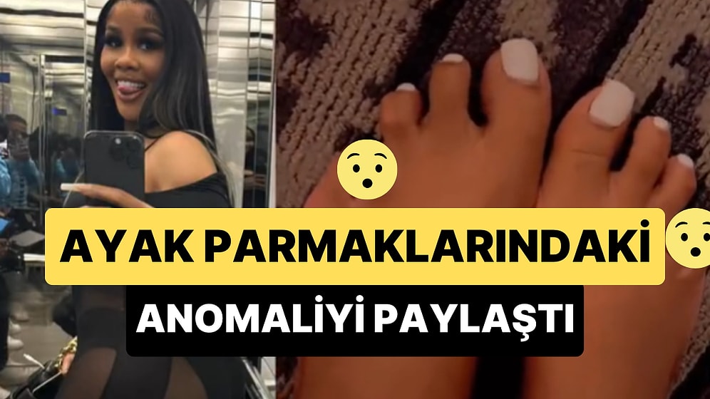 Birlikte Olduğu Erkekler Seviyor Diye Ayak Parmaklarındaki Anomaliyi Düzelttirmeyen ABD'li Şarkıcı Viral Oldu