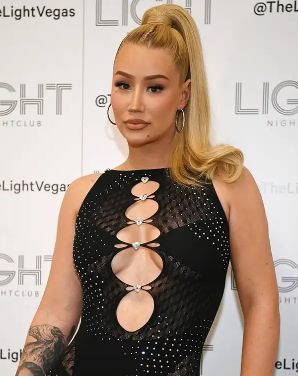 2. Игги Азалия рассказала о пластике носа и грудных имплантатах: «Я не отрицаю этого. Отрицать это глупо»