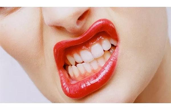 Dişlerin kan dolaşımı, diğer dokulara göre daha sınırlıdır. Bu nedenle, dişlerin iyileşme süreci daha yavaş ve kısıtlıdır.