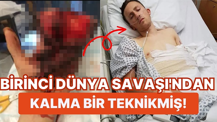 Korkunç Bir Kaza Geçiren İtfaiyecinin Hayatını Kurtarmak İçin Elini Midesine Diktiler!