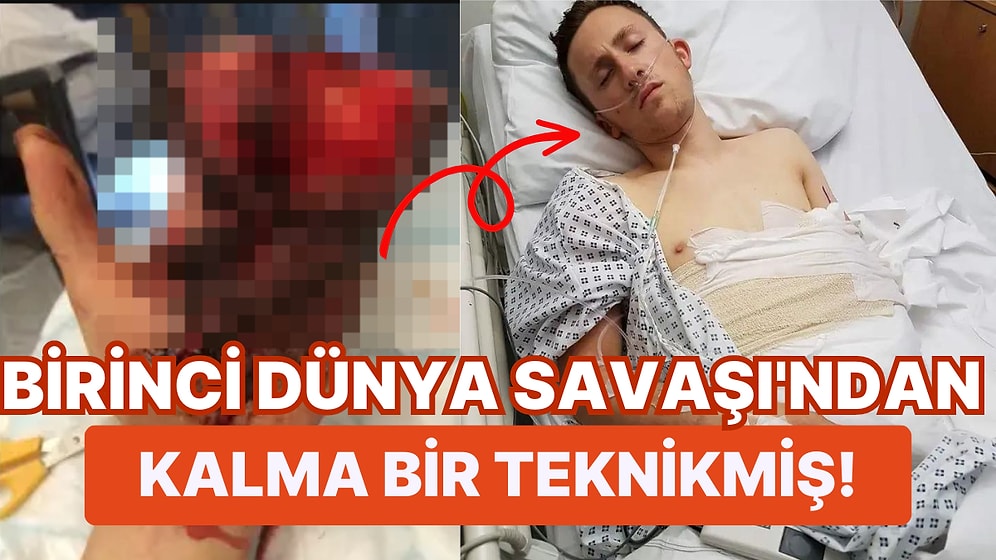 Korkunç Bir Kaza Geçiren İtfaiyecinin Hayatını Kurtarmak İçin Elini Midesine Diktiler!