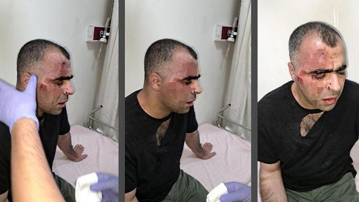 Gazeteciyi Öldüresiye Dövmüşlerdi: 2 Saldırgan Tutuklandı