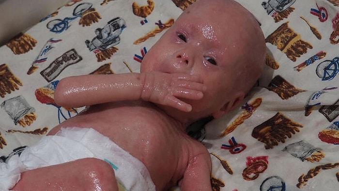 "Yılan Bebeğe" Açılan "Soy Bağının Reddi" Davasında Karar