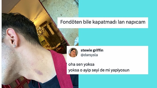 Boynundaki "Seviştim" İzini Kapatmak İçin Tavsiye İsteyen Twitter Kullanıcısına Gelen Komik Tepkiler