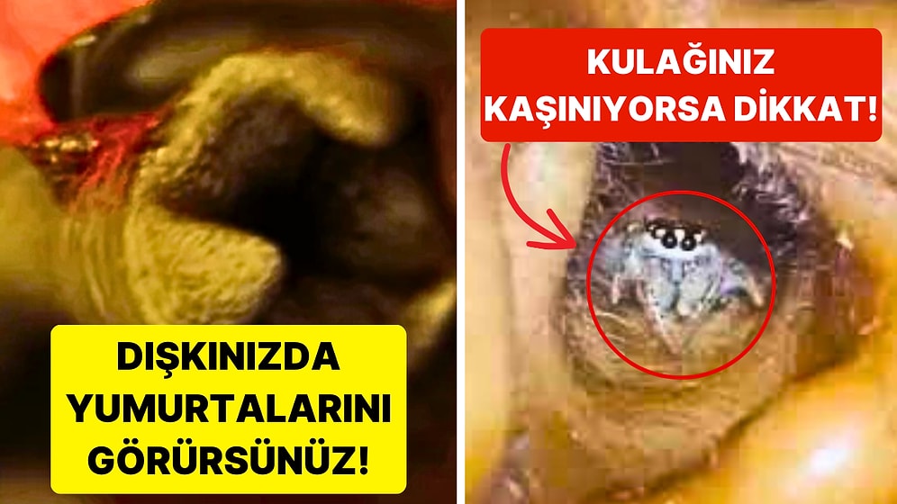 Vücudunuzda ve Hatta Kafınızın İçinde Yaşayabilecek Görünce Tövbe Dedirten 15 Canlı!