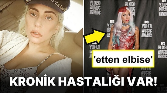 'Çiğ Dana Bifteği' Giymişti: Bi' İlginç Moda Anlayışı ve Kulaklarımızın Pasını Silen Şarkılarıyla Lady Gaga!