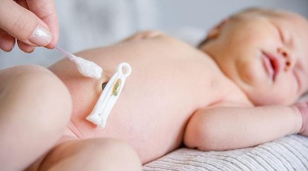 Bazı bebeklerde göbek deliğinin kapanması daha uzun sürebiliyor. Böyle durumlarda 6 aya kadar göbek deliğinin kapanması sürebilir.