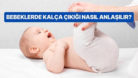 Bebeklerde Kalça Çıkığı Nedir? Tedavisi Nasıl Olur?