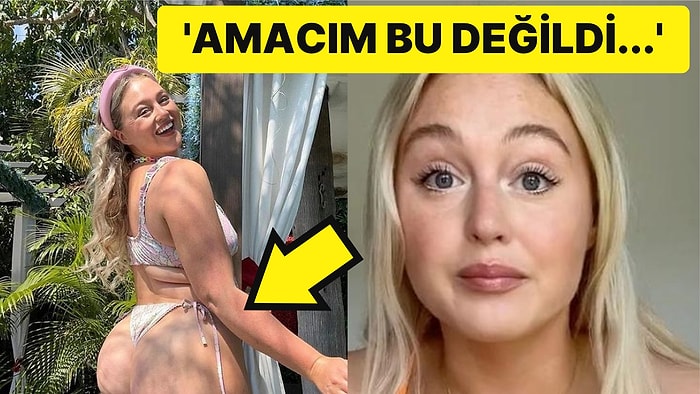 'Vücut Olumlaması' Yaparak Ünlü Olan Modelin Selülit Kremi Reklamı Yapması Sosyal Medyada Tepki Çekti!