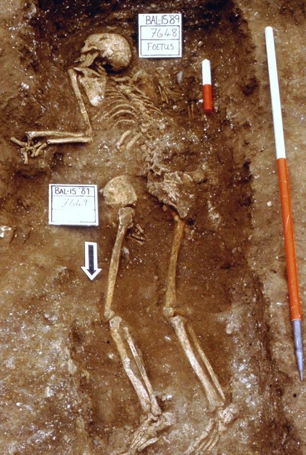 11. Antik Roma'da anne ve üçüz bebeklerin mezarı bulundu. Bu kalıntı dünyada bilinen en eski üçüz vakası.