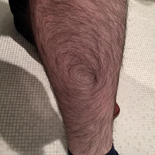10. "Bacağımdaki kıllar spiral bir şekilde uzuyor."