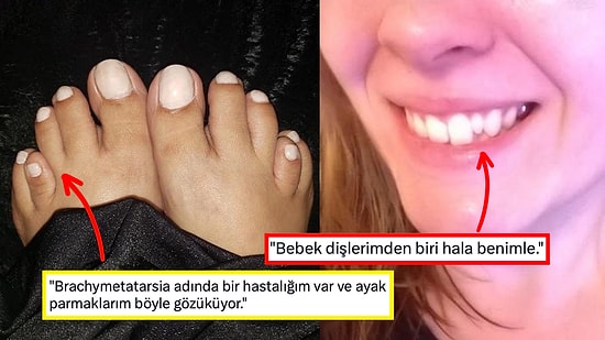 Sahip Oldukları Birbirinden Eşsiz Fiziksel Özellikleri Paylaşarak Herkesi Dumura Uğratan 15 Kişi