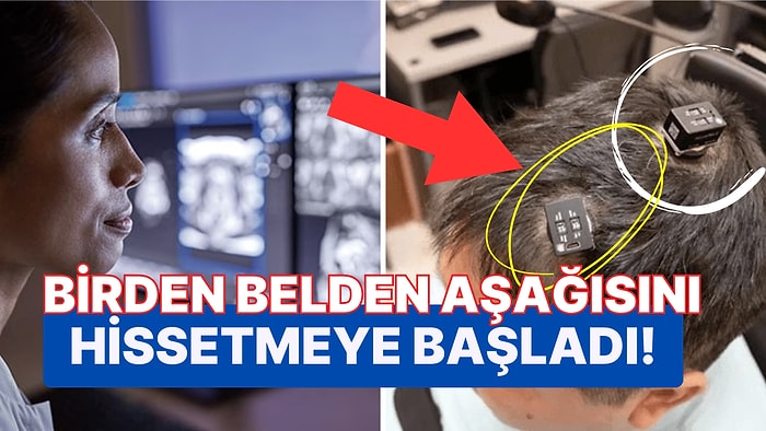 Yapay Zeka ile Beyin Bağlantısı Yeniden Kurularak İyileşen Felçli Hastanın Yaşadıkları Hepimizi Dumur Etti