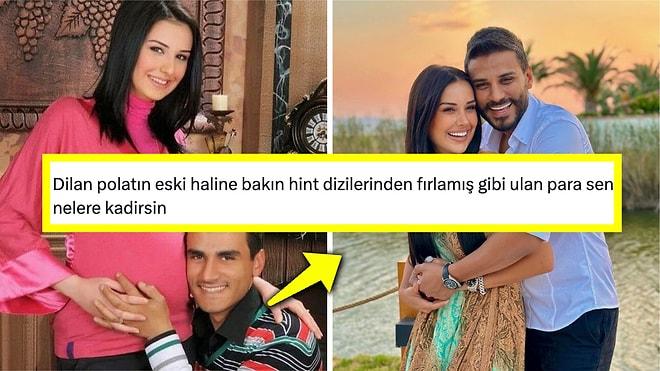 Dilan Polat ve Eşinin Lüks Yaşantılarından Önceki Hâlleri Sosyal Medya Halkının Diline Düştü!