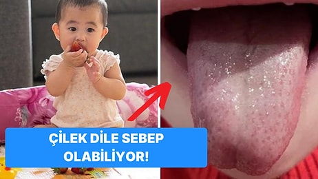 Anne ve Babaların Yüreğine Tarif Edilemez Bir Korku Salan Çocuk Hastalığı Kawasaki Sendromu Nedir?