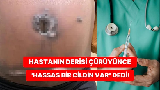 Diyabet Hastası Kadın, Doktoru Tarafından Bilgilendirilmeden Estetik Ameliyat Geçirince Derisi Çürüdü!