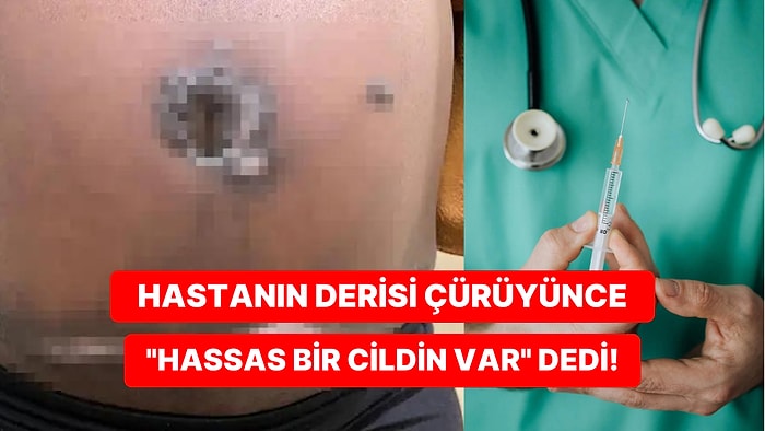 Diyabet Hastası Kadın, Doktoru Tarafından Bilgilendirilmeden Estetik Ameliyat Geçirince Derisi Çürüdü!