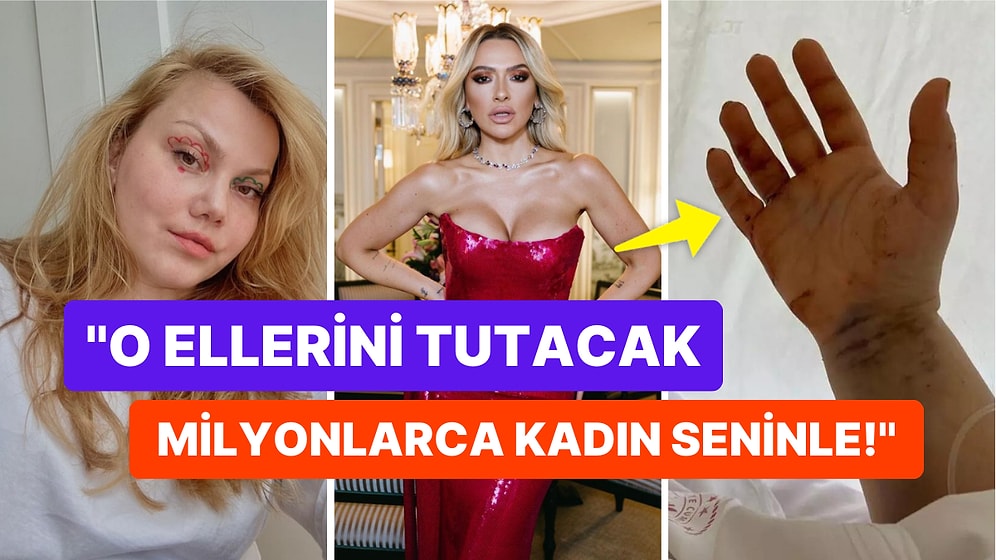 Kadına Şiddete Sessiz Kalmayan Hadise'den 32 Yerinden Bıçaklanan Fenomen Merve Veziroğlu'na Destek