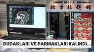 Beyin Cerrahı Restoranda Karşılaştığı Bir Kadının Sadece Dış Görünüşüne Bakarak Beyin Tümörü Teşhisi Koydu