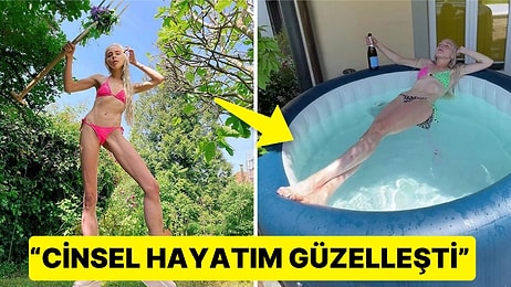 Sevgilisinin Zorbalığından Dolayı Bacak Uzatma Ameliyatı Olan Kadının Beyin Yakan Açıklamaları