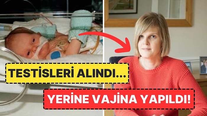 Hasarlı Bir Penisle Dünyaya Geldiği İçin Bebekken Testisleri Alınan Kadının Akıllara Durgunluk Veren Hikayesi