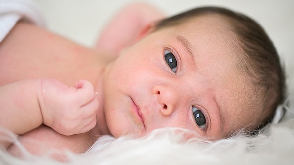 Bebekler doğdukları andan itibaren bazı sorunlar yaşabiliyorlar. Bunlardan biri de gözyaşı tıkanıklığı.