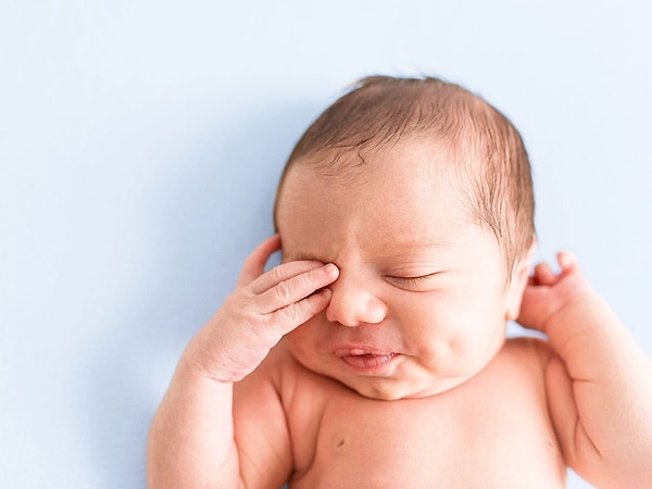 Kanaldan burna geçemeyen gözyaşı, bebeğin önce gözyaşı kesesinde birikiyor. Daha sonra ise göz kapaklarından dışarı akıyor ve sulanmaya neden oluyor.