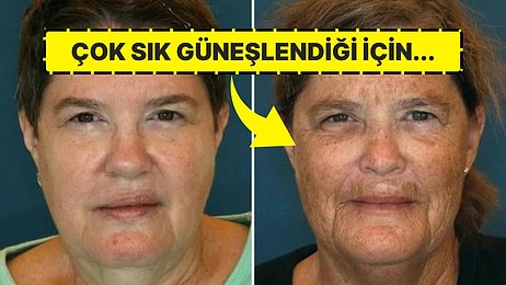 Sigara Kullanıp Çok Sık Güneşlendiği İçin İkiz Kardeşinden Son Derece Farklı Görünen Kadın!