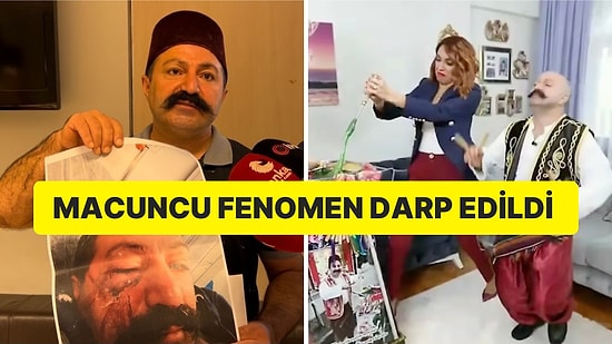 Ünlü Sosyal Medya Fenomeni Ev Sahibinin Kardeşi Tarafından Darp Edildi: ''Ölebilirdim''