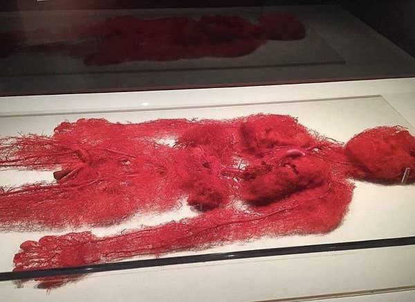 10. Ürkütücü ama vücudumuzdaki tüm kan damarları böyle görünüyor.