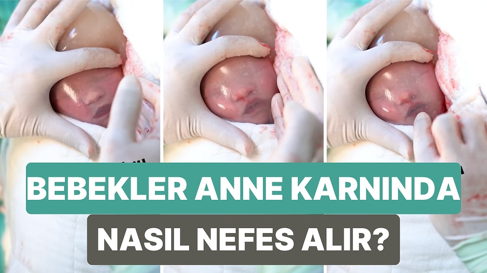 Bebeklerin Anne Karnında Nasıl Nefes Aldığını Aminyon Kesesi ile Doğan Bir Bebek ile Gösteren Doktor