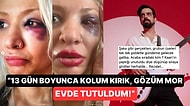 Yüzyüzeyken Konuşuruz'un Üyesi Can Tunaboylu'nun Sevgilisini Darp Ettiği İddiası Ortalığı Ayağa Kaldırdı