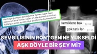 Sevgilisinin Röntgen Filmine Yükselen Kadın Hepimizi Yeniden Aşka İnandırdı