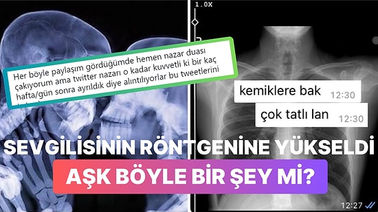 Sevgilisinin Röntgen Filmine Yükselen Kadın Hepimizi Yeniden Aşka İnandırdı