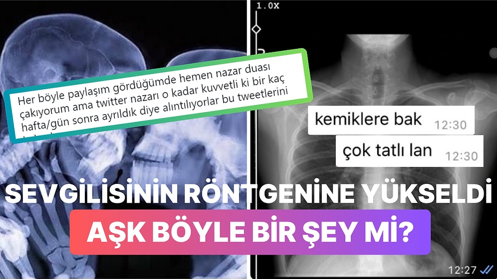 Sevgilisinin Röntgen Filmine Yükselen Kadın Hepimizi Yeniden Aşka İnandırdı