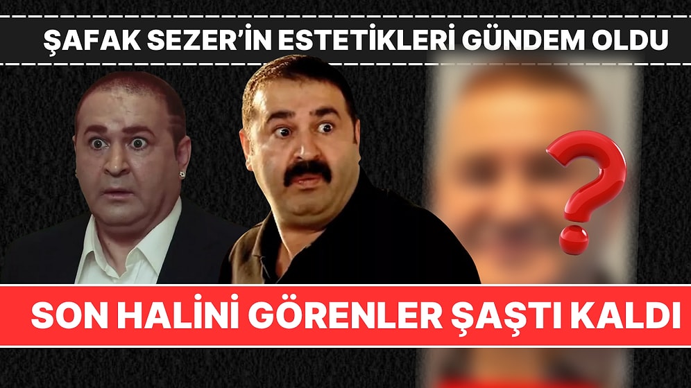 Şafak Sezer, Estetiğin Dozunu Kaçırdı! Son Hali Görenleri Şaşkına Çevirdi