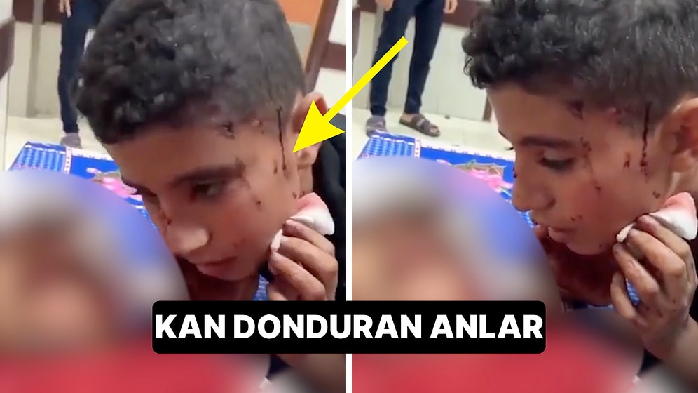İsrail’in Gazze’deki Hastane Saldırısında Bir Çocuk Kardeşine Şehadet Getirmeyi Öğretti