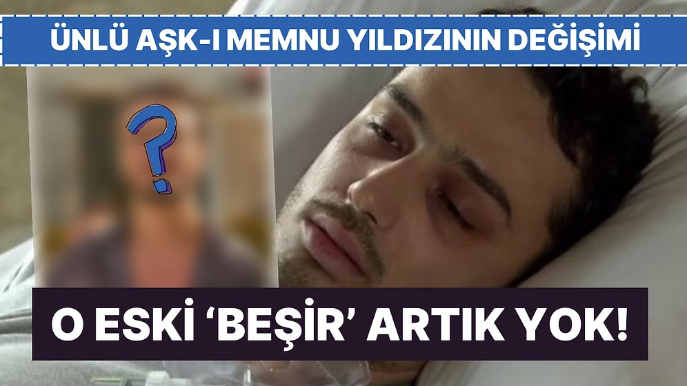 O Eski Halinden Eser Yok Şimdi: Aşk-ı Memnu'nun Beşir'i Baran Akbulut'un Dikkat Çeken Değişimi