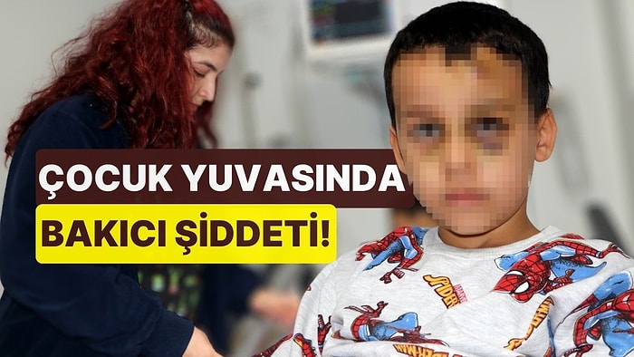 Çocuk Yuvasında Bakıcı Şiddeti! 8 Yaşındaki Çocuk 6 Gün Yoğun Bakımda Kaldı