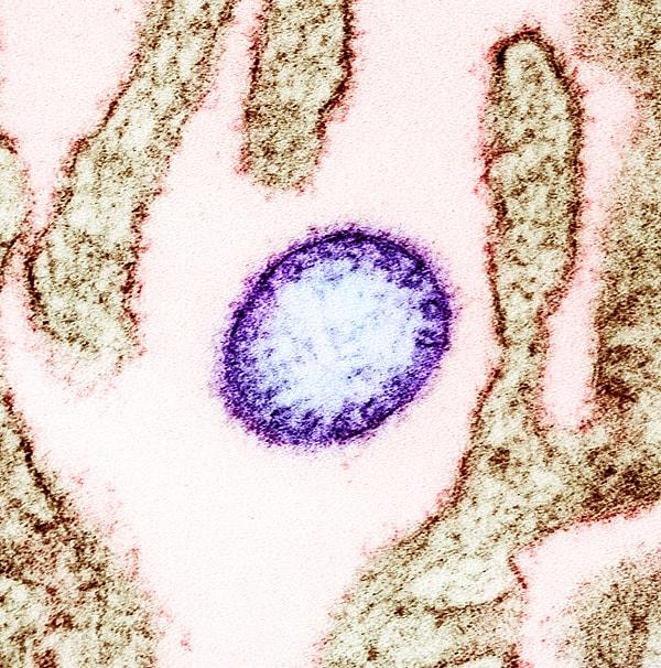 Bu virüslerden biri olan Nipah virüsü, merkezi sinir sistemi ve hayati organları çevreleyen hücreleri düzenleyen reseptörleri enfekte edebilir.