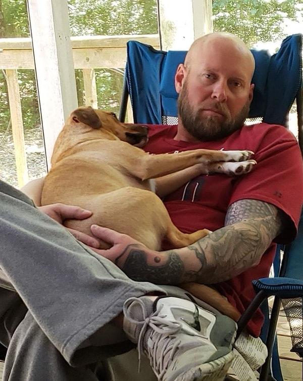 Arkansaslı 46 yaşındaki Aaron James, Haziran 2021'de yüzünün elektrik teline temas etmesi sonucu 7.200 voltluk bir elektrik şokuna maruz kalarak sol gözünü, baskın sol kolunu, burnunu ve dudaklarını kaybetti.