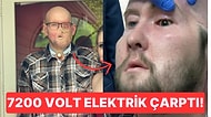 7200 Voltluk Elektrik Çarptıktan Sonra Gözünü Kaybeden Adama İlk Kez Tam Göz Nakli Yapıldı