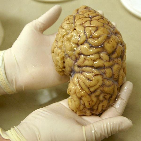 Bu deneyi yürüten nörologlardan oluşan ekip, beyin aktivitesinin 5 saat boyunca minimum değişiklik gösterdiğini belirtti.