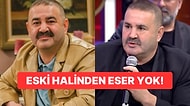 Botoksun Ayarını Fazla Kaçıran Şafak Sezer'in Son Halini Görenler Gözlerine İnanamadı!