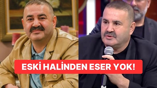 Botoksun Ayarını Fazla Kaçıran Şafak Sezer'in Son Halini Görenler Gözlerine İnanamadı!