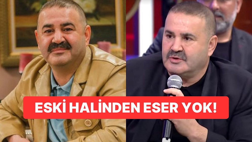 Botoksun Ayarını Fazla Kaçıran Şafak Sezer'in Son Halini Görenler Gözlerine İnanamadı!