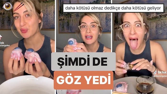 İşlenmemiş Gıda Diyeti Yaparken Birbirinden İlginç Etleri Çiğ Çiğ Yiyen Doktor Şimdi de 'Göz' Yedi