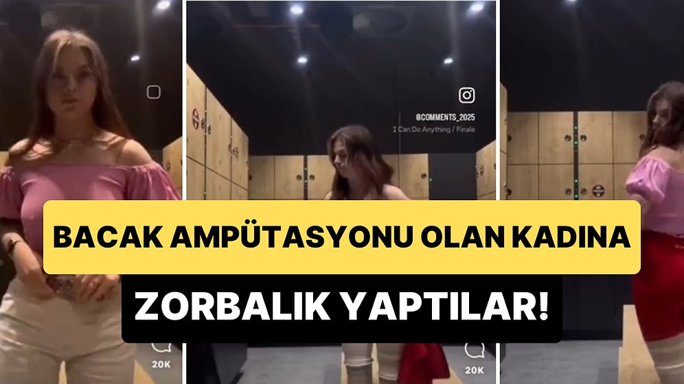 Bacak Ampütasyonu Olan Kadına Yapılan Zorbalığa 'Yok Artık' Diyeceksiniz!
